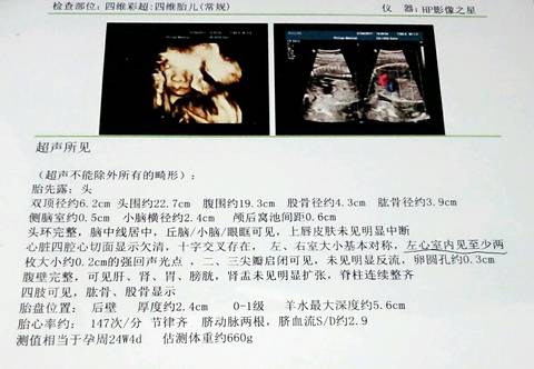 journal_insert_pic_641324134