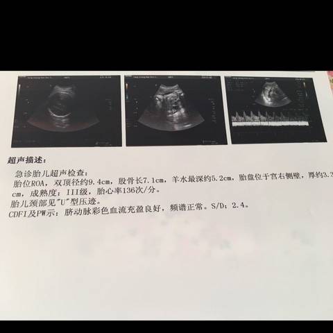 journal_insert_pic_644139136