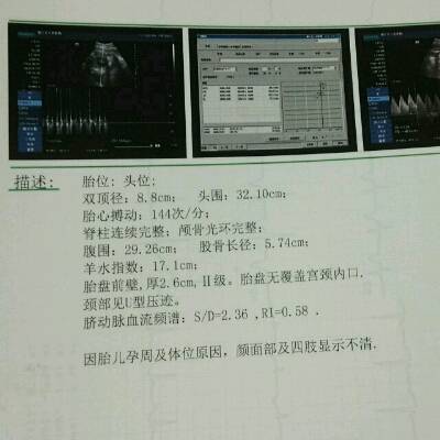 journal_insert_pic_645442595