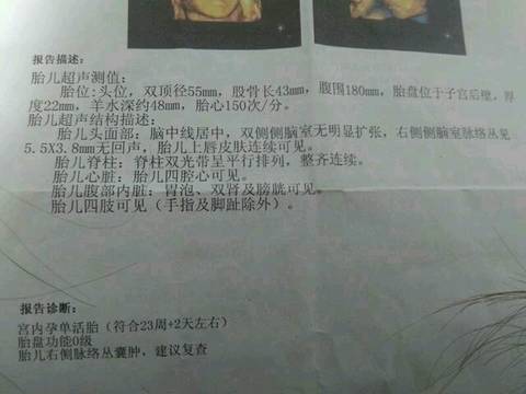 journal_insert_pic_646126588
