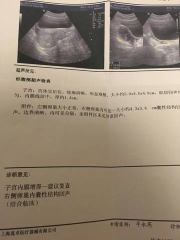 journal_insert_pic_650533481