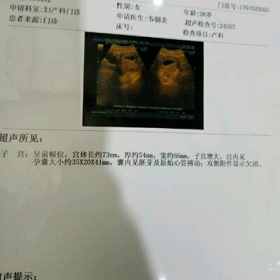 journal_insert_pic_650153286