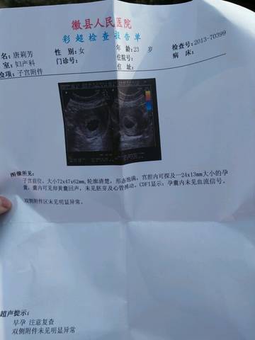 journal_insert_pic_654528645
