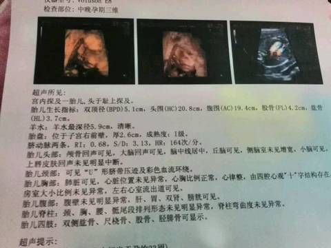 journal_insert_pic_654870698