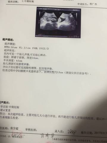 journal_insert_pic_655318581