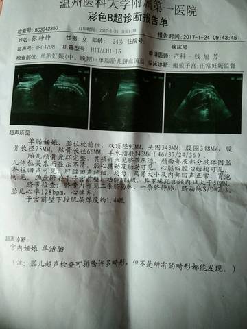 journal_insert_pic_655205551