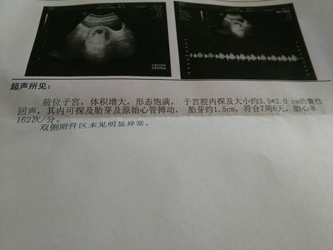 journal_insert_pic_656464470