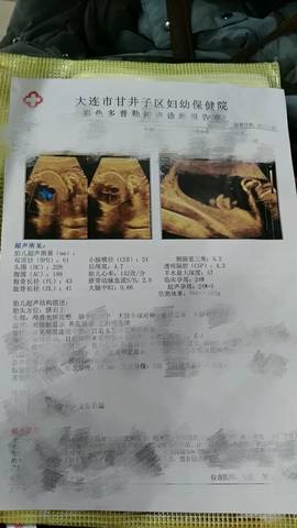 journal_insert_pic_658850027