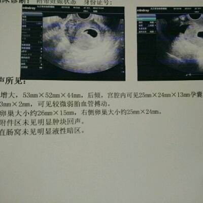 怀孕39天b超显示可见较微弱胎血管搏动是什麼意思?_宝宝树