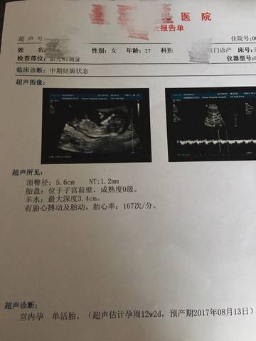 journal_insert_pic_659213683
