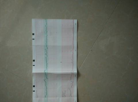 journal_insert_pic_660904755