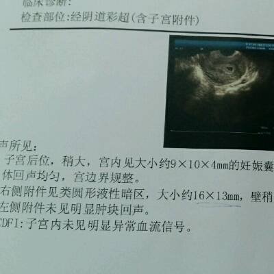 journal_insert_pic_660805977
