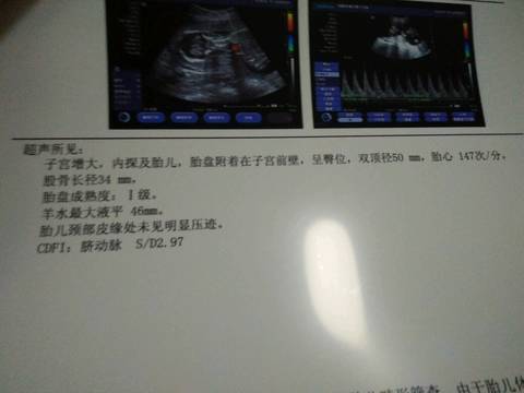 journal_insert_pic_660753214