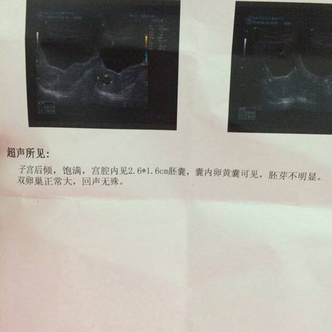 journal_insert_pic_662620023