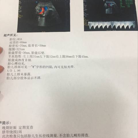 journal_insert_pic_665093048