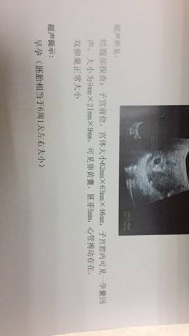 journal_insert_pic_665059414