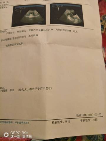 journal_insert_pic_667122798
