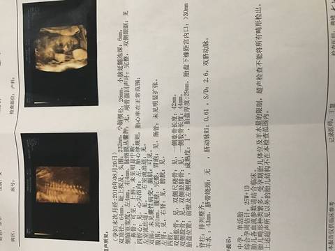 journal_insert_pic_666975186