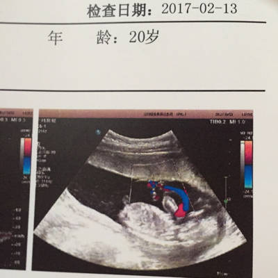 孕十八周胎儿发育图片图片