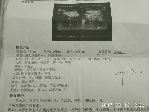 journal_insert_pic_671380049