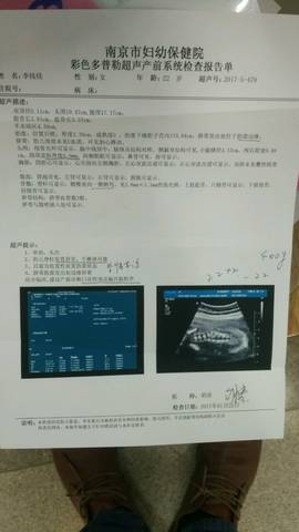 journal_insert_pic_673106576