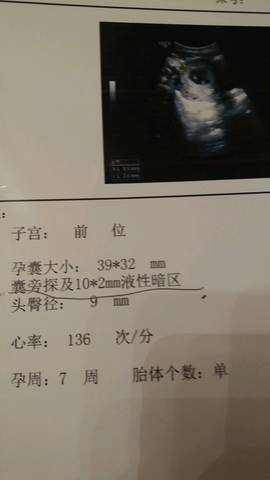 journal_insert_pic_674140214