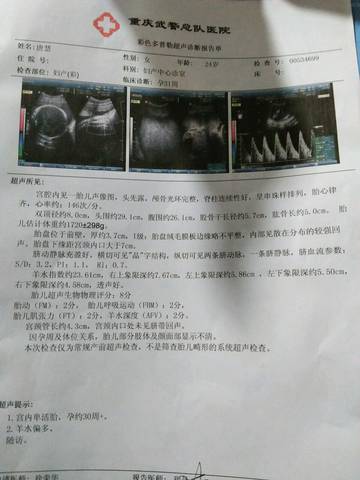 journal_insert_pic_677800903