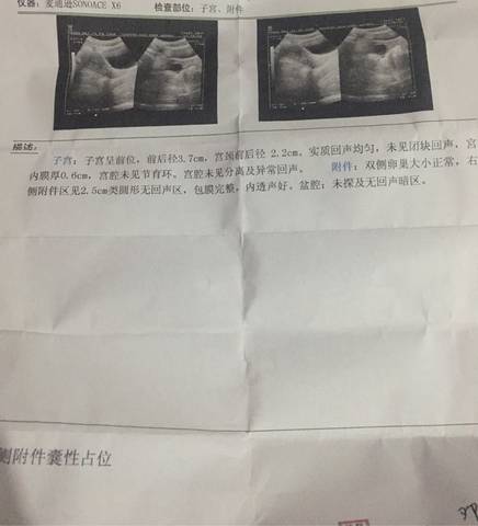 journal_insert_pic_678977174