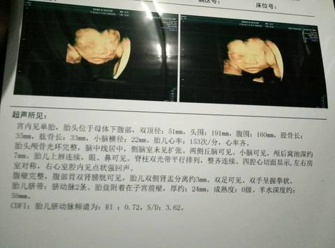 journal_insert_pic_681388539