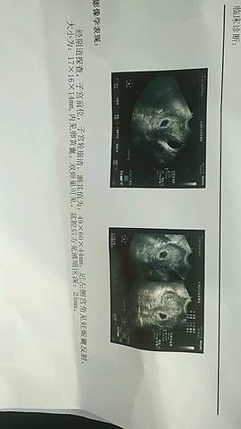 journal_insert_pic_682477003
