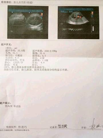 journal_insert_pic_683313926