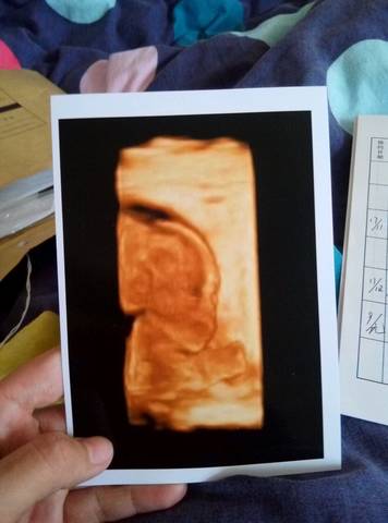 journal_insert_pic_685519390