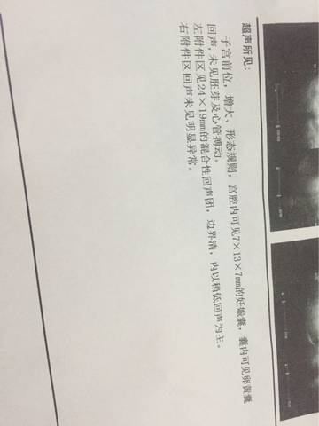 journal_insert_pic_686238239
