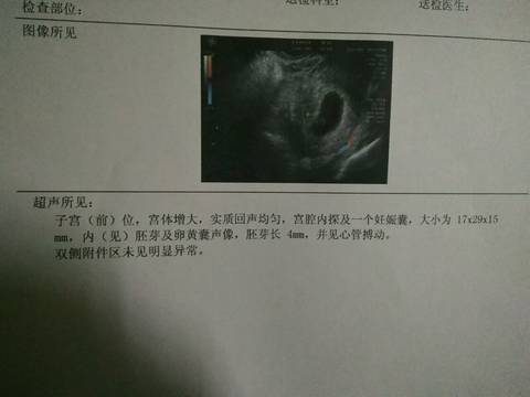 journal_insert_pic_686856660