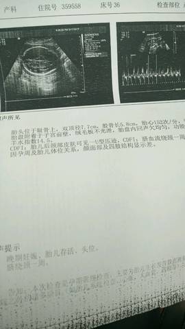 journal_insert_pic_687310284