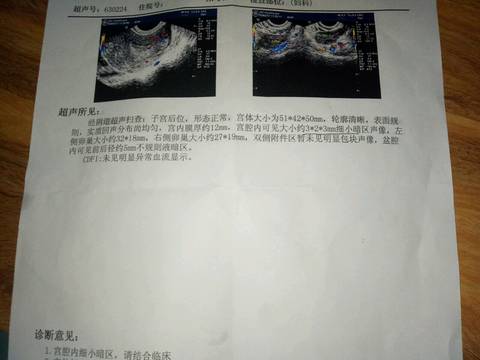 journal_insert_pic_687948923