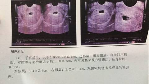 journal_insert_pic_689649144