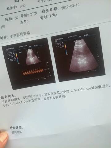 journal_insert_pic_690331068