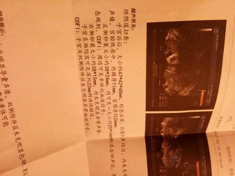 journal_insert_pic_692352722