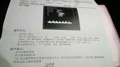 journal_insert_pic_692766778