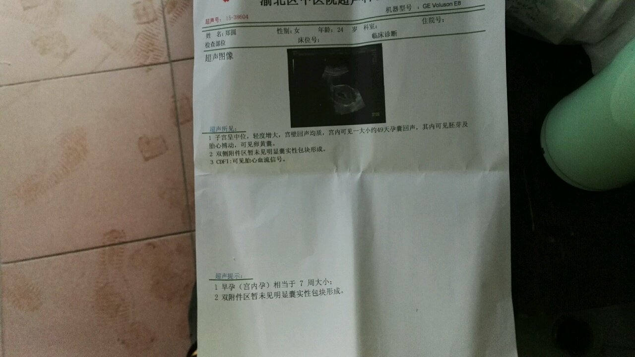 怀孕七周