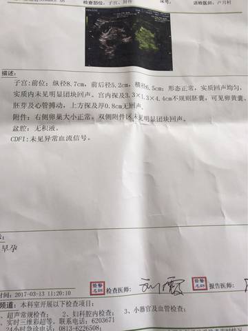 journal_insert_pic_692513632