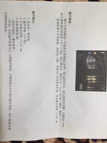 journal_insert_pic_692493204