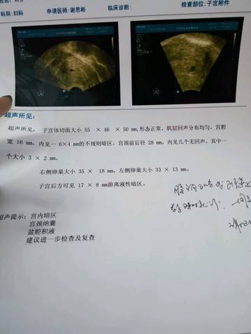 journal_insert_pic_693225533
