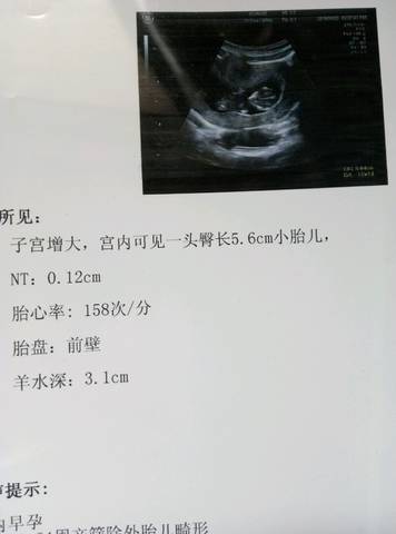 journal_insert_pic_695639420