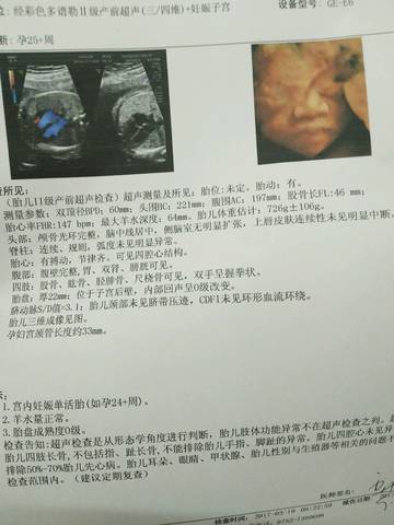 journal_insert_pic_696888062