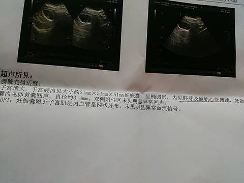 journal_insert_pic_697034084