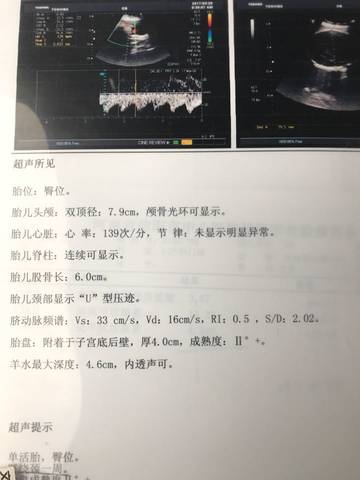 journal_insert_pic_698068172
