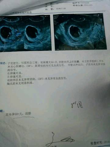 journal_insert_pic_697727605