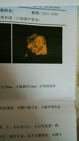 journal_insert_pic_699238349